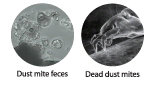 Các loại bọ ve gây dị ứng và phân của chúng dưới kính hiển vi